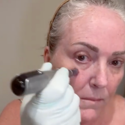 VERA Rejuvenating Pen
