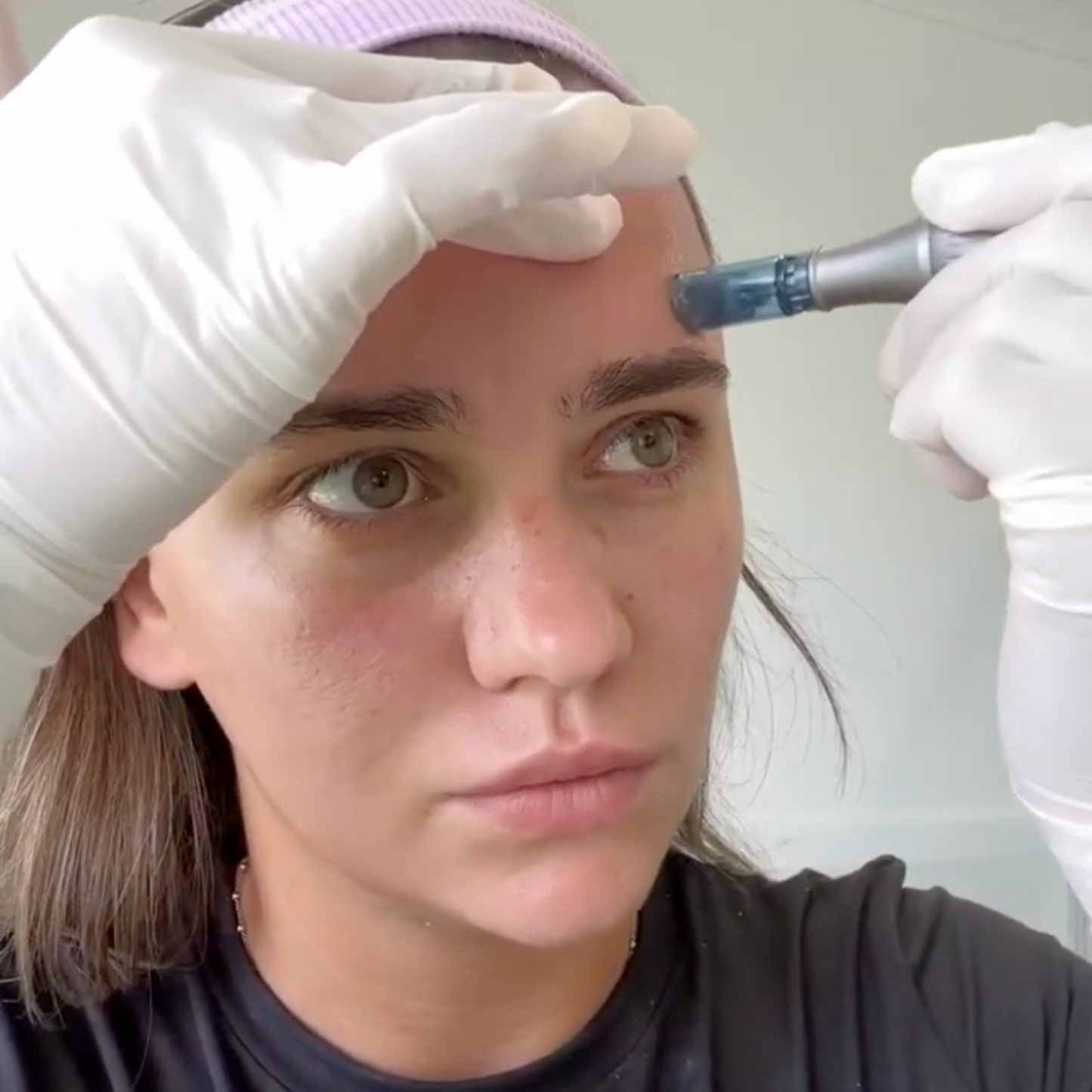 VERA Rejuvenating Pen