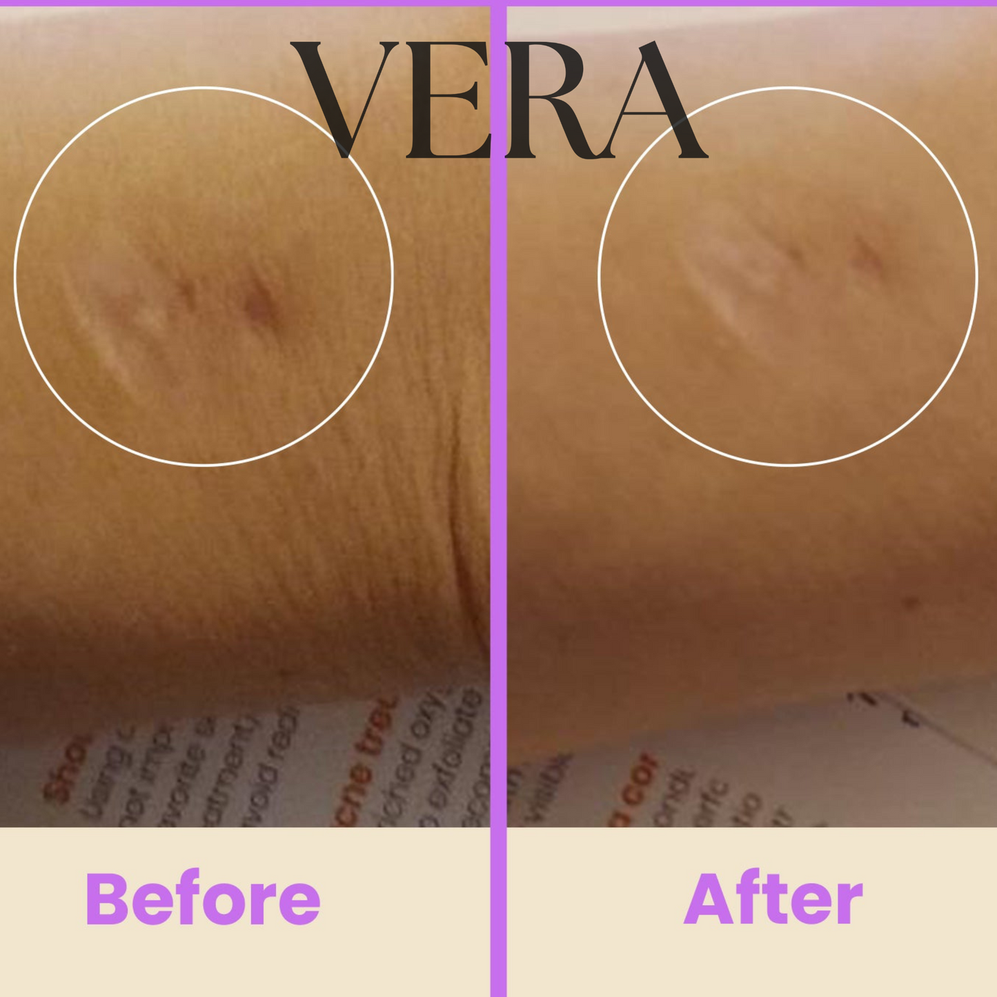 VERA High Frequency Glow Wand