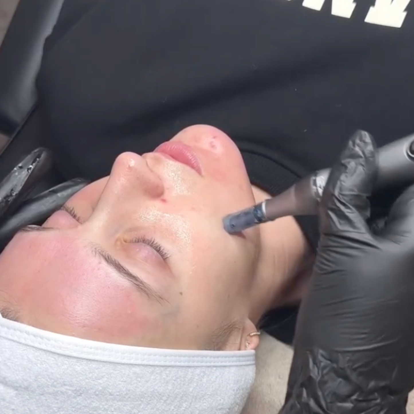 VERA Rejuvenating Pen